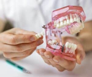 Making You Smile Porcelain Dental Bridge New York Cosmetic Dentist Near You