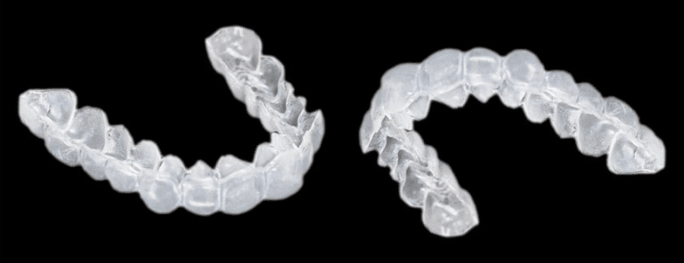 aligners