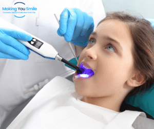 Dental Sealants For Children (1) making you smile dental studio new york city