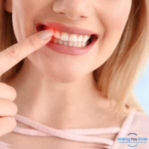 Making You Smile Gum Disease In New York City
